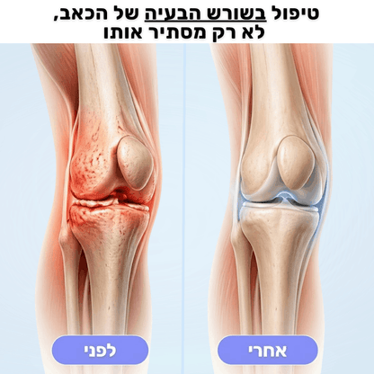 ReviKnee™